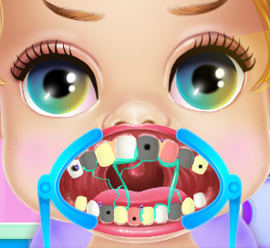 Зубной врач: Брекиты для малышки принцессы